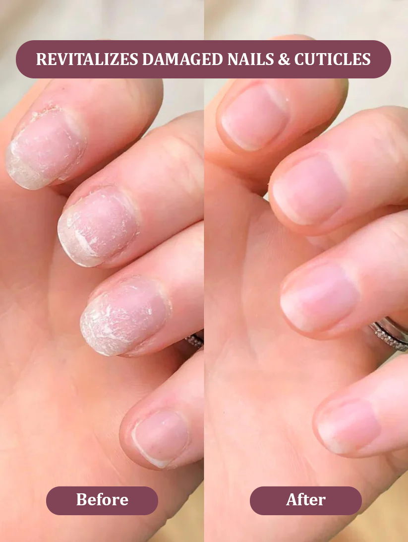 CANDY Nail Growth Oil